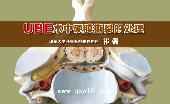 山東奧蘇本UBE雙通道脊柱內(nèi)鏡微創(chuàng)手術(shù)系統(tǒng)的技術(shù)