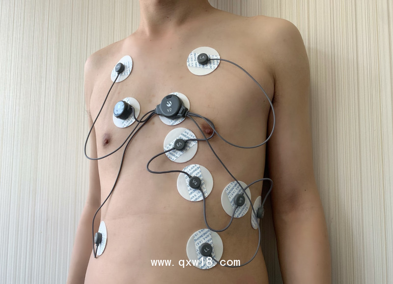 動(dòng)態(tài)心電記錄儀 穿戴式心電記錄儀