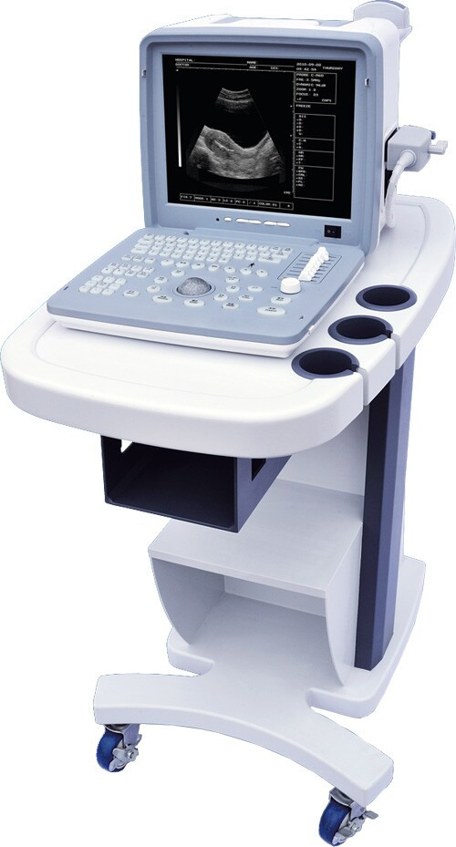 全數(shù)字超聲顯像診斷儀廠家直銷便攜式黑白B超機