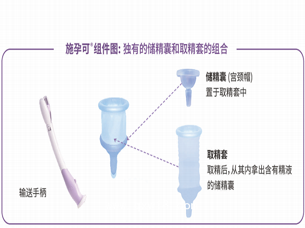 美國施孕可授精輔助系統(tǒng)家用助孕器