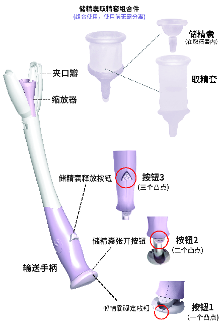 伊孕可輔助授精系統(tǒng)家用助孕器