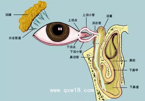一次性使用淚道引流管