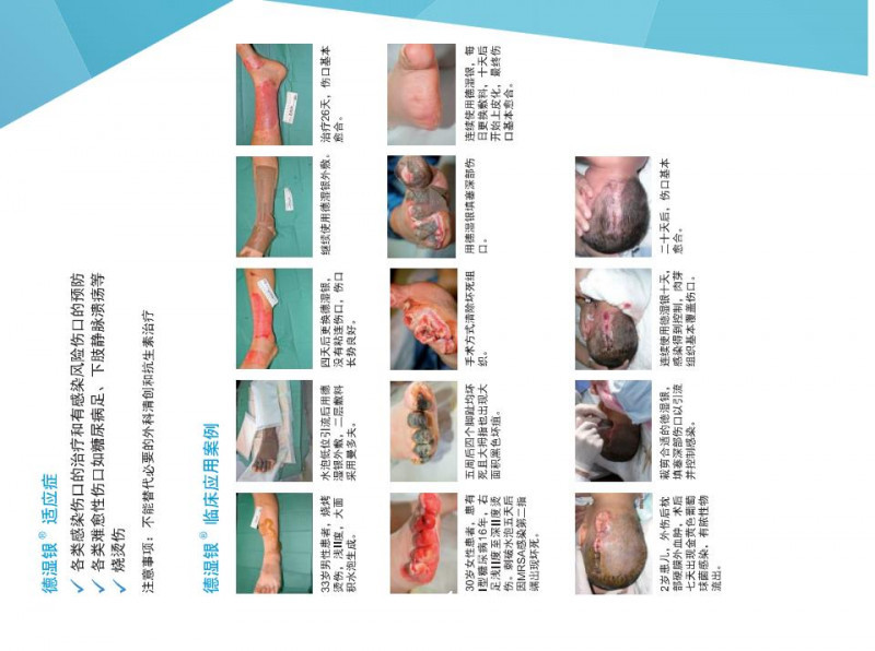 德濕銀敷料、銀離子