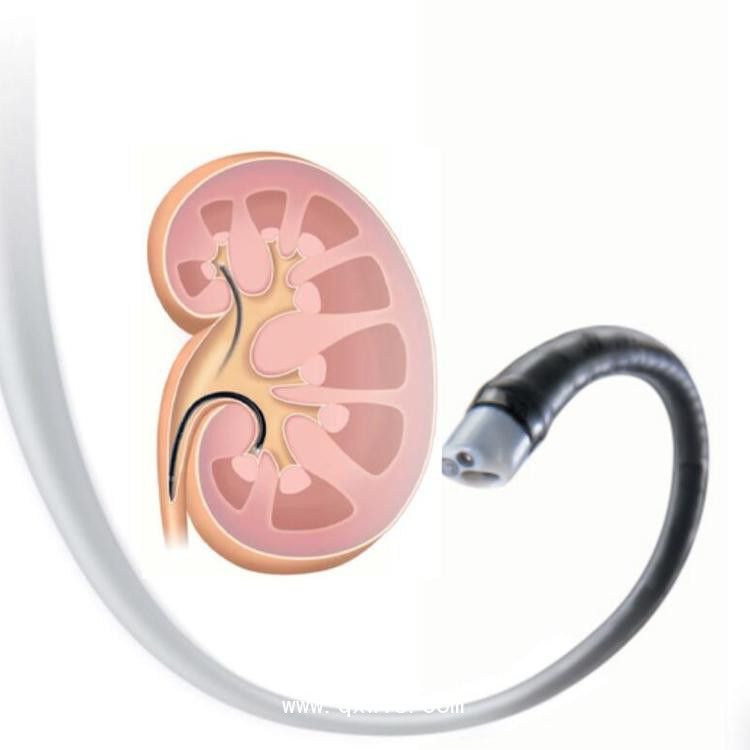 奧林巴斯輸尿管軟鏡 URF-P6