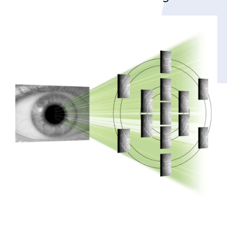 日本多美Tomey EM-4000角膜內(nèi)皮細胞顯微鏡