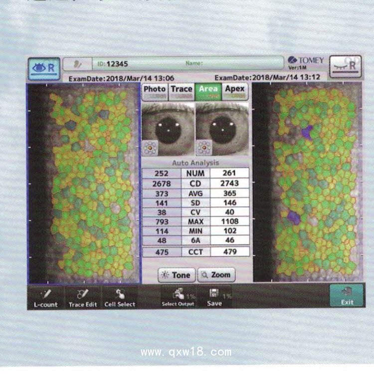 日本多美Tomey EM-4000角膜內(nèi)皮細胞顯微鏡