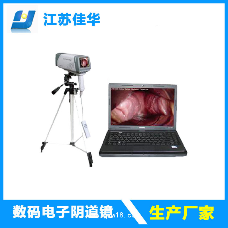 光電一體陰道鏡 光電陰道鏡 數(shù)碼陰道鏡