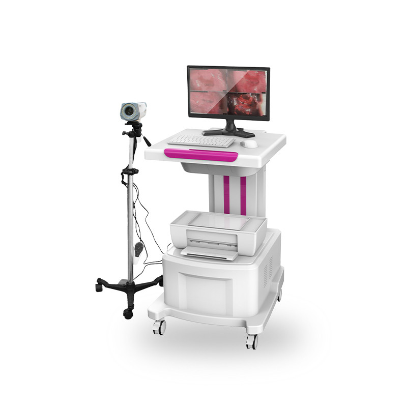 電子陰道鏡  婦科電子陰道鏡  數(shù)碼電子陰道鏡