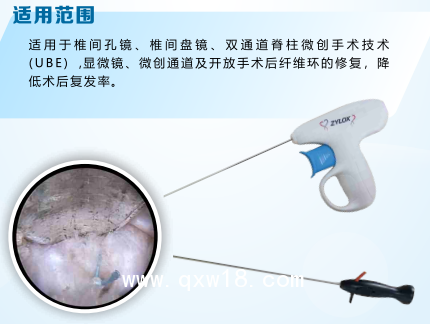 一次性纖維環(huán)縫合器修復(fù)術(shù)使用醫(yī)院