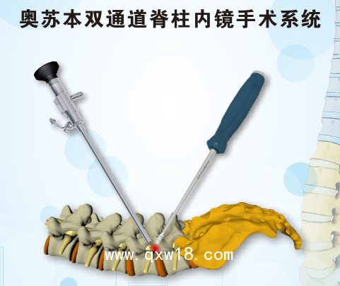 骨科脊柱微創(chuàng)手術器械 山東奧蘇本生產(chǎn)廠家