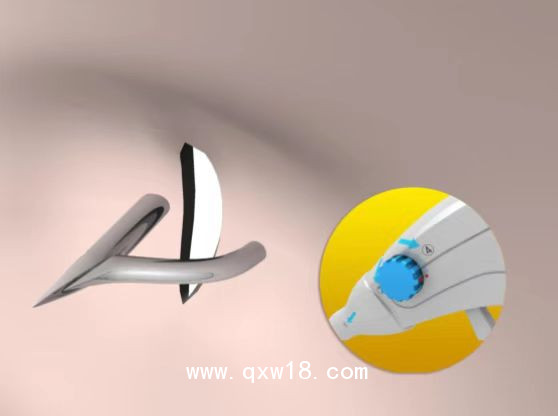 纖維環(huán)縫合器