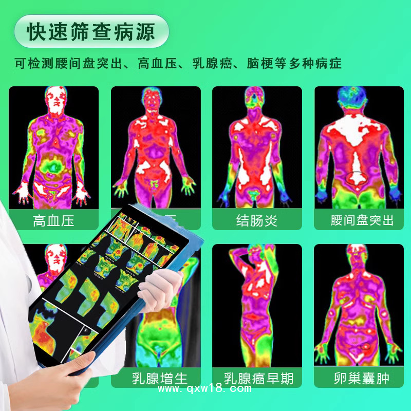 中醫(yī)熱ct體質(zhì)健康測(cè)試儀醫(yī)用紅外線成像儀透視機(jī)CT醫(yī)用成像儀
