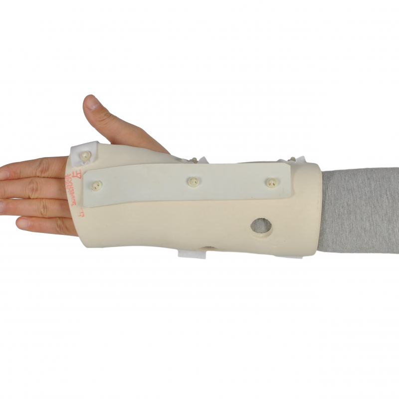世康恒達(dá) 醫(yī)用外固定支具 塑形橈骨支具