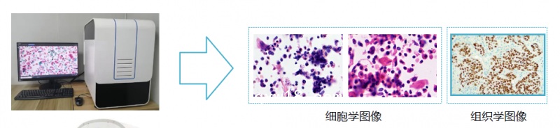 子宮內(nèi)膜癌篩查細胞醫(yī)學(xué)圖像分析系統(tǒng)