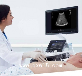 醫(yī)用超聲診斷儀HS40、XH40型號三星麥迪遜彩超