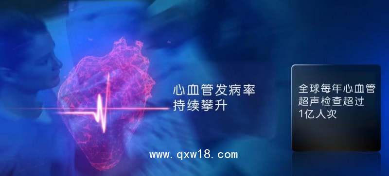 GE彩色多普勒超聲診斷儀B超儀器彩超設(shè)備四維彩超