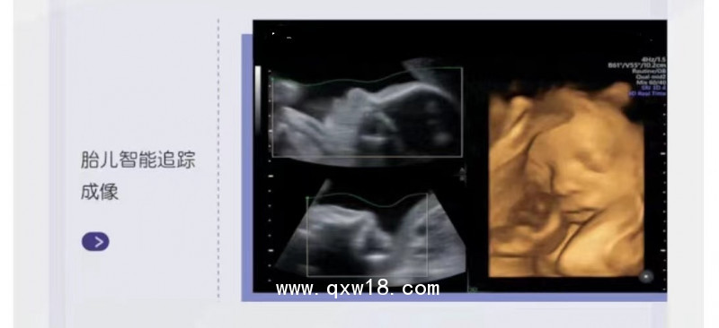 GE彩色超聲診斷儀B超儀器彩超設(shè)備美國(guó)通用