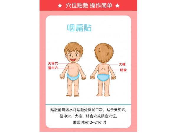 小兒兒童咽扁貼批發(fā)代理定制定做醫(yī)院診所OEM