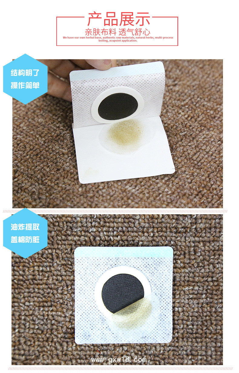 小兒兒童咽扁貼批發(fā)代理定制定做醫(yī)院診所OEM