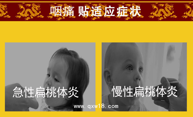 小兒咽痛貼批發(fā)代理定制定做醫(yī)院診所中標(biāo)掛網(wǎng)
