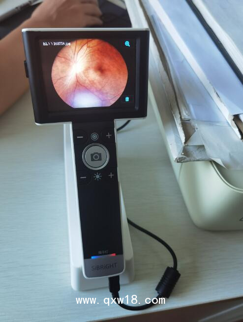AIFCS10型手持眼底照相機