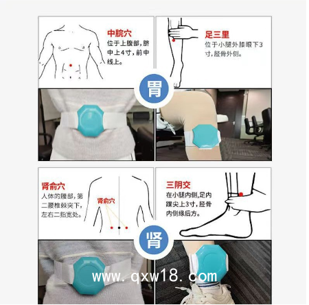 康企糖尿病電子理療儀儀降血糖儀器高血糖治療儀