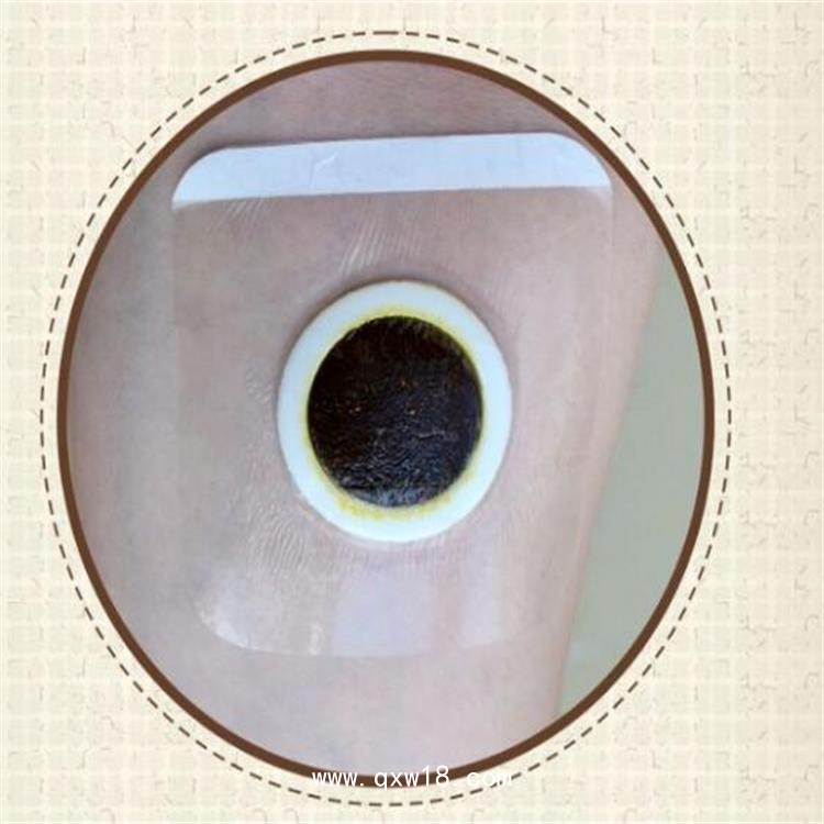二類械字號穴位磁療貼批發(fā)定制