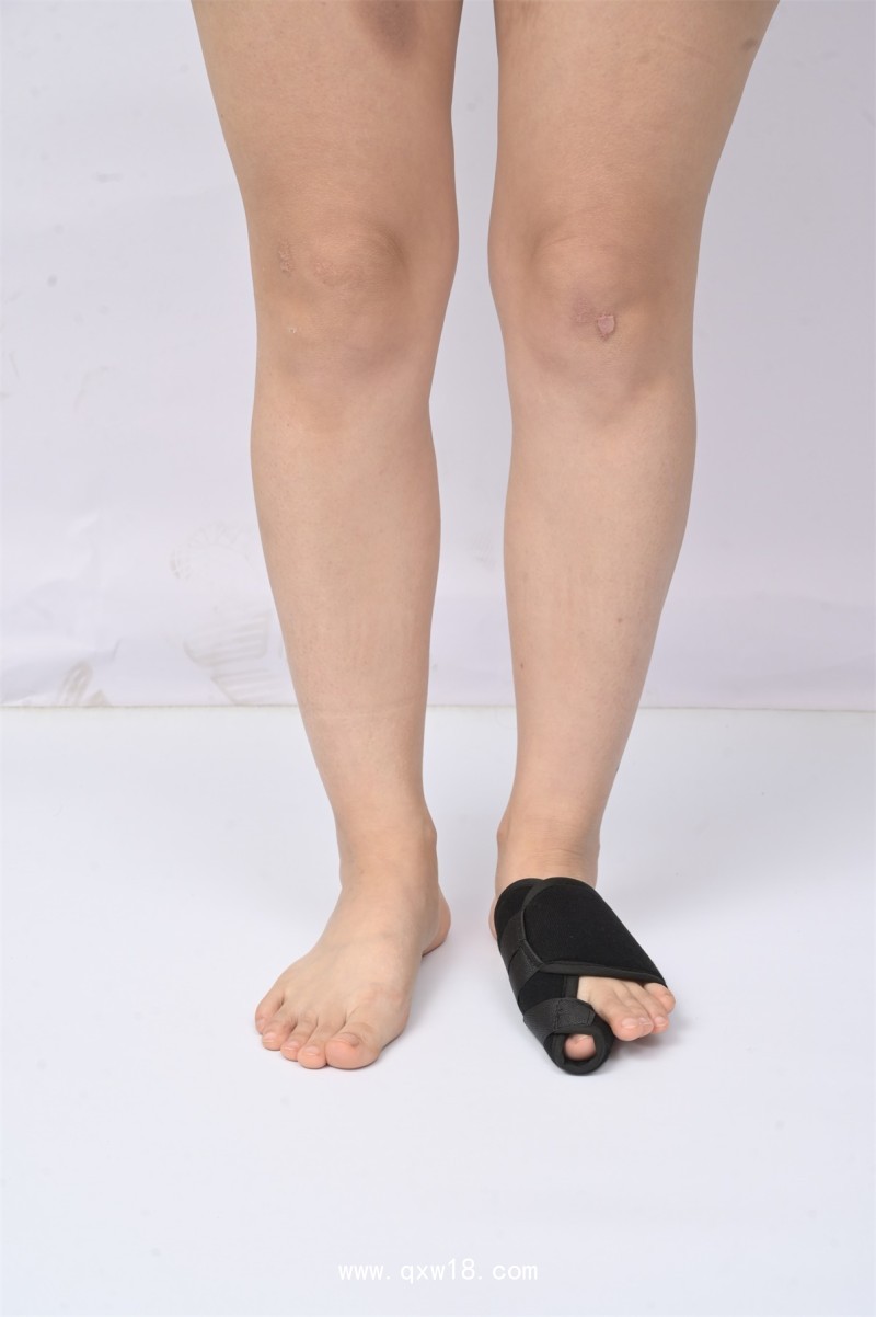 腳拇指外翻固定帶