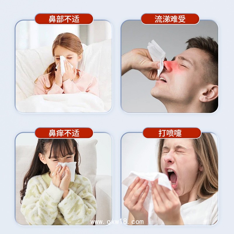 鼻炎貼廠家 四貼裝 成人/兒童均有 可批發(fā)可定制 免費(fèi)打樣