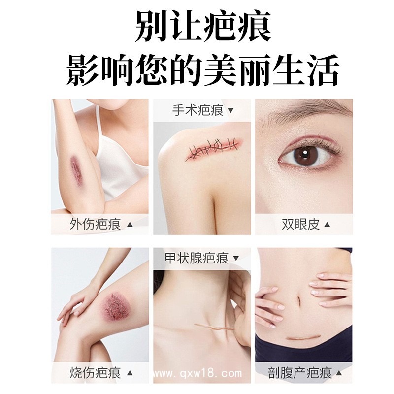 醫(yī)用疤痕貼代加工/可定制不同規(guī)格尺寸械字號/0元拿樣全流程質(zhì)檢