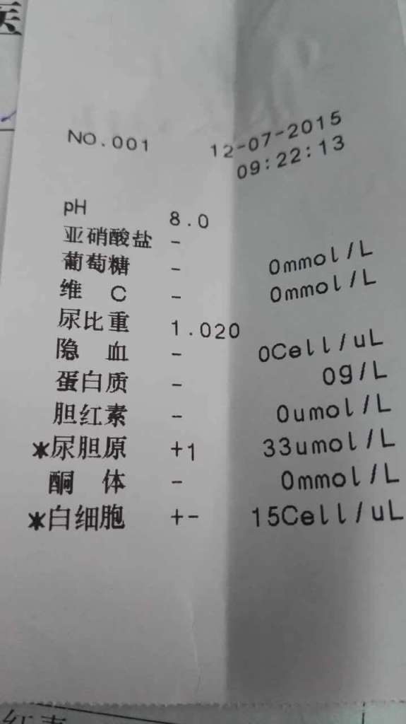 尿液打印結(jié)果