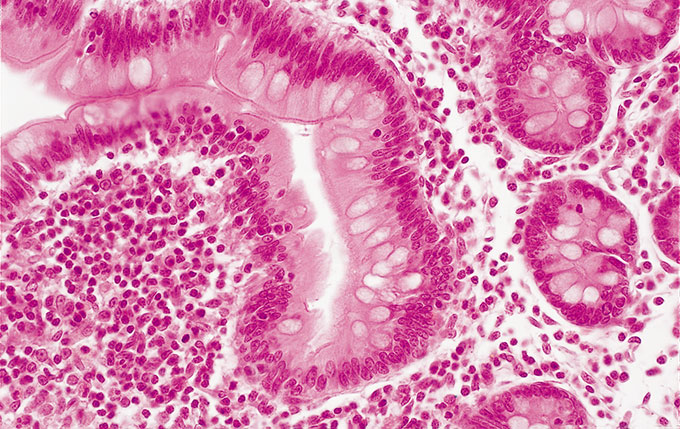 1453964471982070.jpg 1453964471982070.jpg