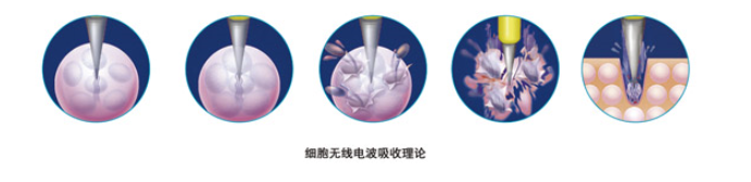 1533539166708827.png image.png