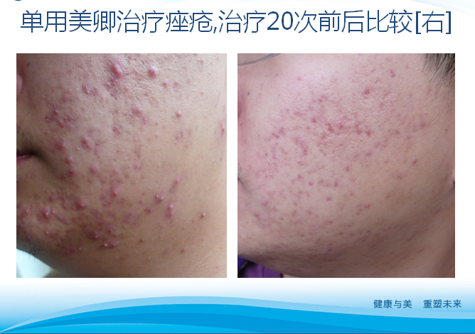 1565591809915703.png image.png