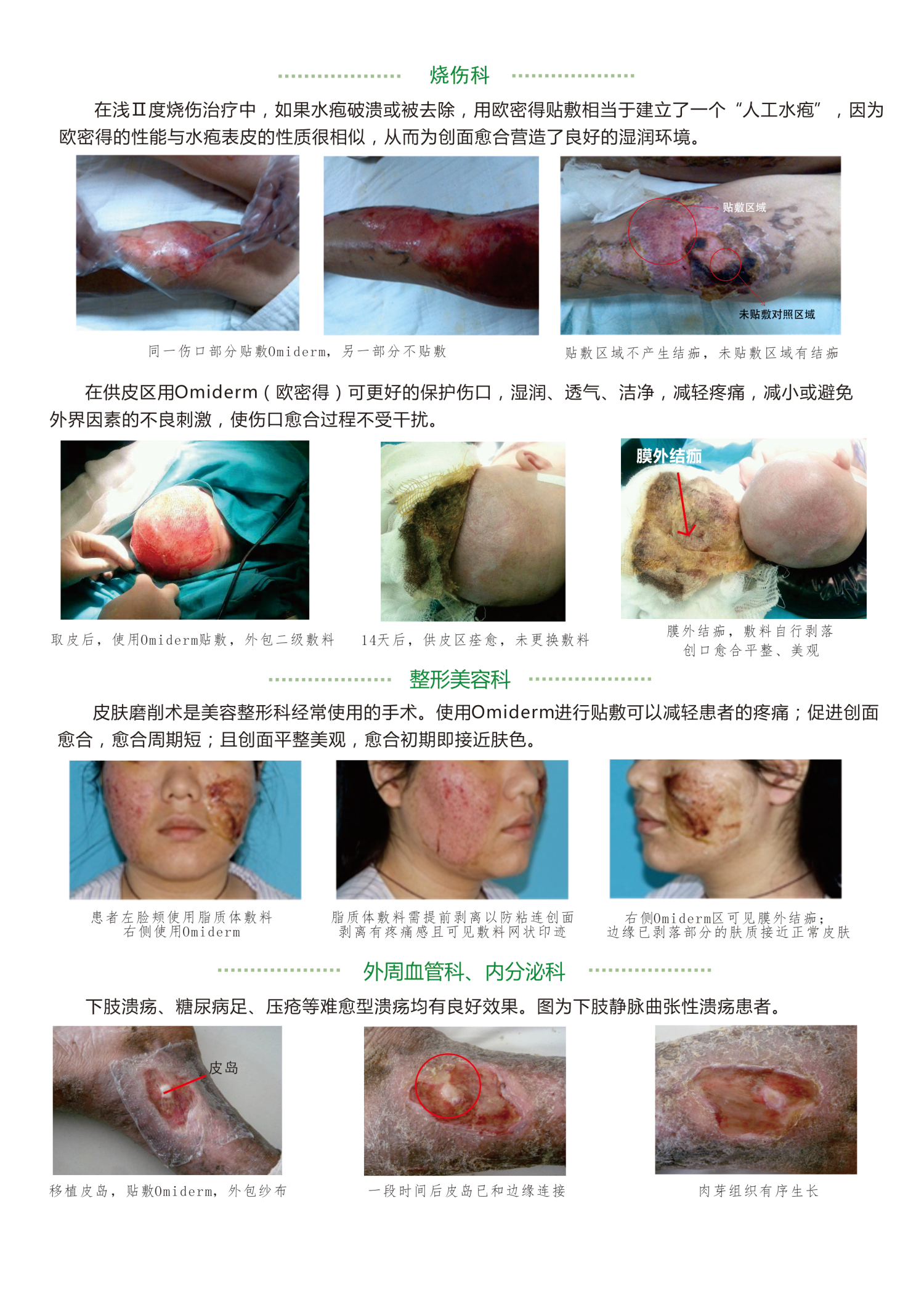 1572507594829698.jpg 皮膜3_編輯.jpg