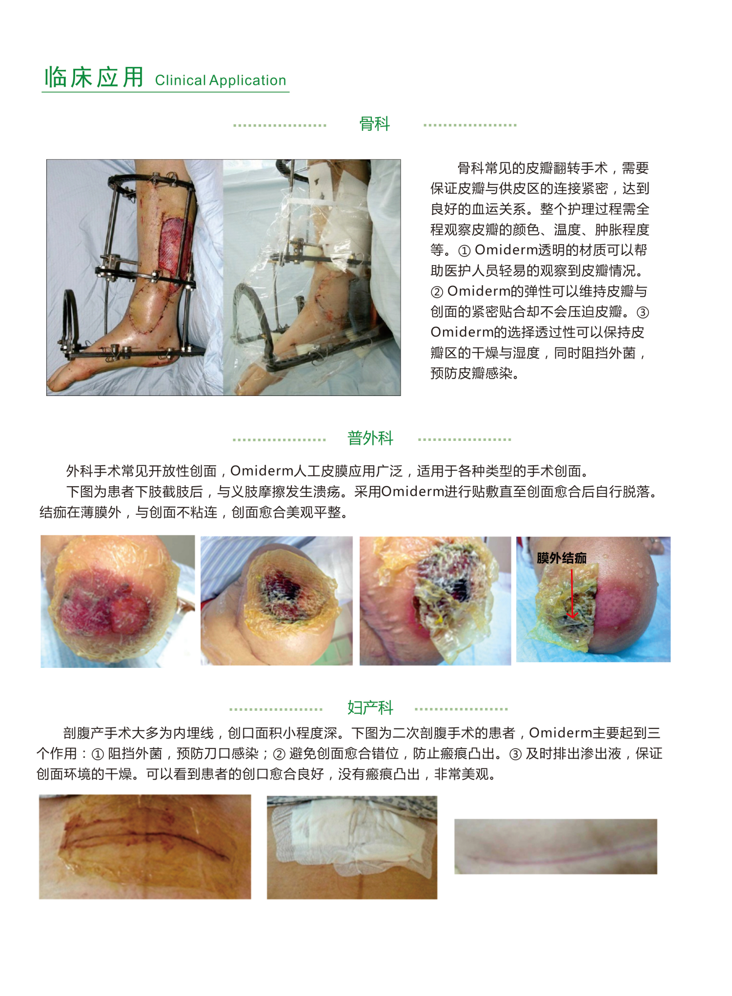 1572507613684914.jpg 皮膜4_編輯.jpg