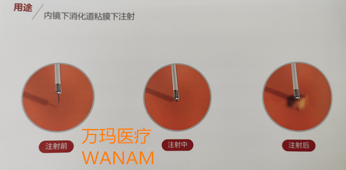 一次性內(nèi)鏡用注射針2_副本.jpg