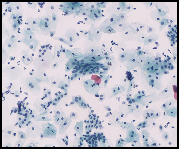 1603864928879592.png 1005_dst2.png