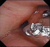 ENF-VT2-12.jpg ENF-VT2-12.jpg