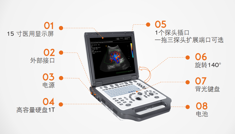 便攜式彩超設(shè)備 便攜式彩超設(shè)備