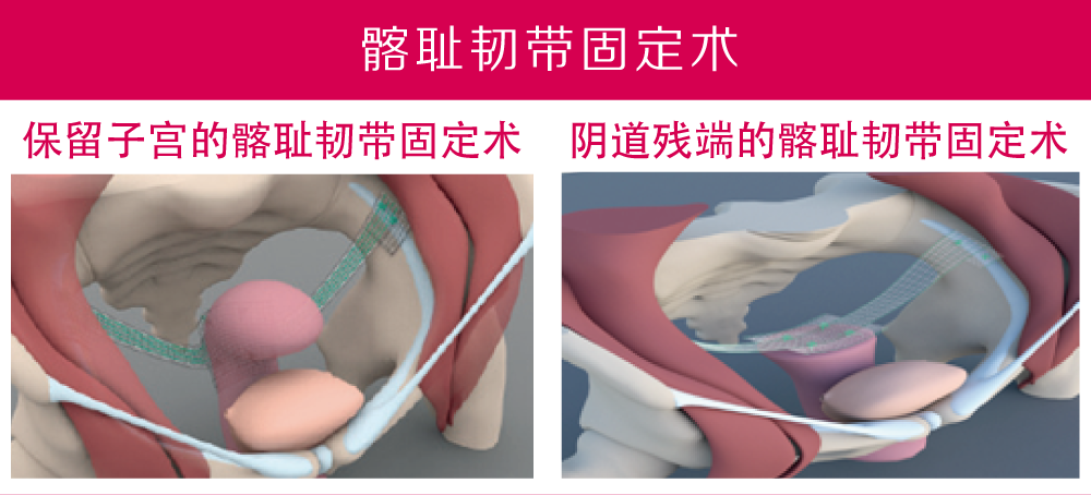 1661838143583201.png 未標(biāo)題-2.png