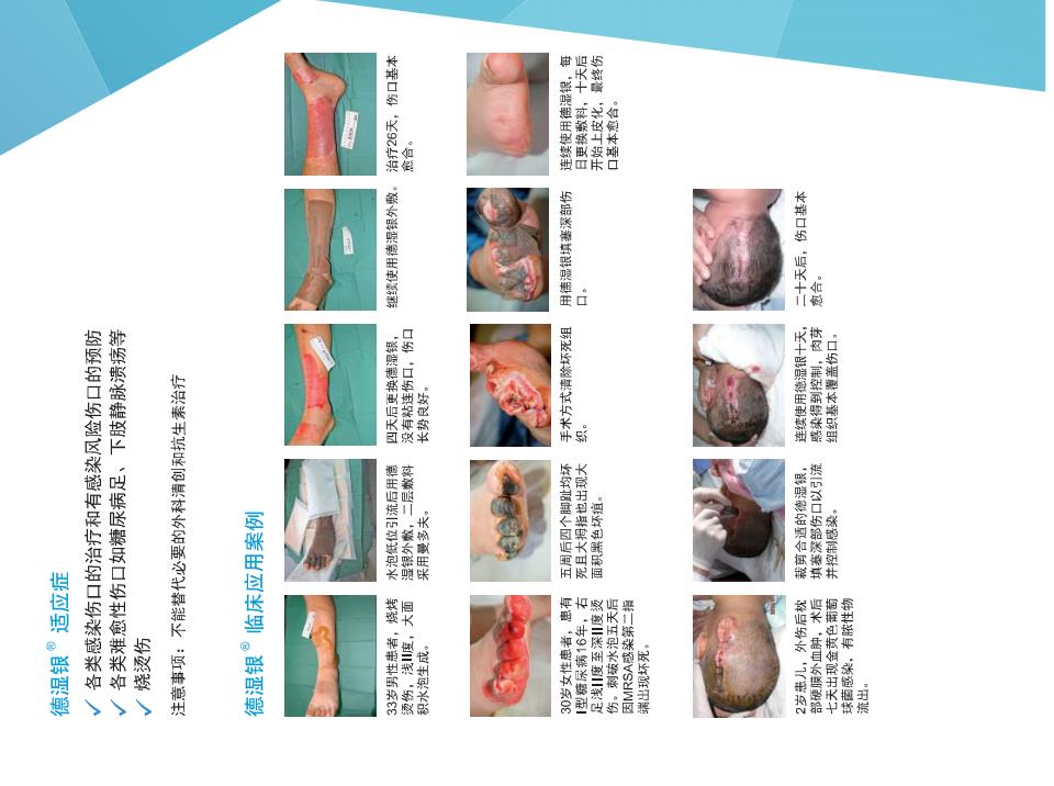 1664425740346009.jpg 德濕銀.jpg