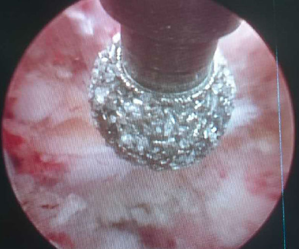 1681194430913165.jpg c9f755a37436ba4f9b3df6d2e67c2a1.jpg