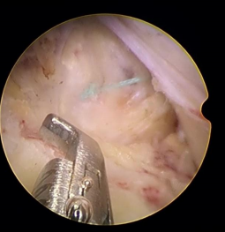 1683600560230649.png a6f35ddac520d084ef81f77ec91db3c.png