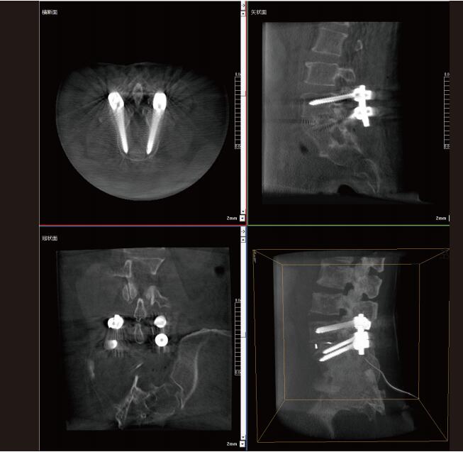 大功率平板三維C形臂影像 大功率平板三維C形臂影像