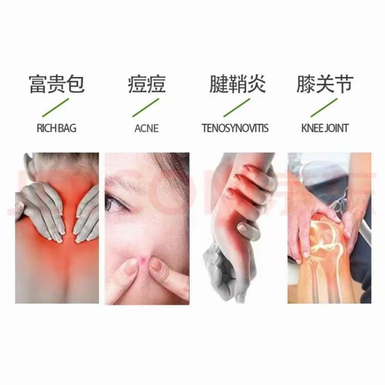 筋骨冷敷凝膠，涂抹型、械字號