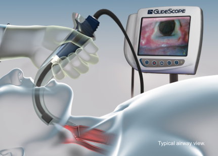 20220321143159_57072